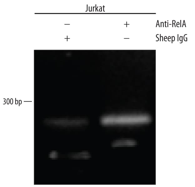 Detection of RelA/NF kappa B p65-regulated Genes by Chromatin Immuno-precipitation.