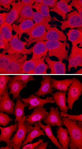 RelA/NF?B p65 antibody in HeLa Human Cell Line by Immunocytochemistry (ICC).