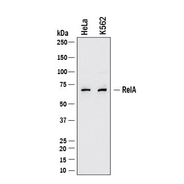 Detection of Human and Mouse RelA/NF?B p65 antibody by Western Blot.