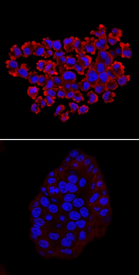 Phospho-RelA/NFkB p65 (S536) antibody in HT-29 Human Cell Line by Immunocytochemistry (ICC).