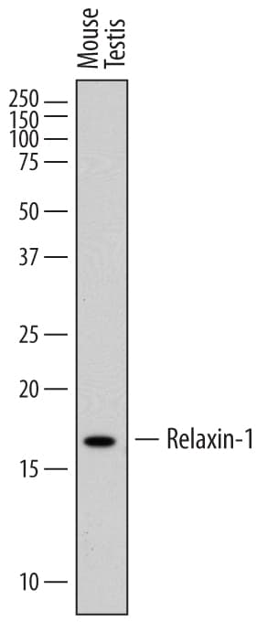 Detection of Mouse Relaxin-1 antibody by Western Blot.