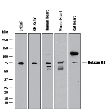 Detection of Human, Mouse, and Rat Relaxin R1 antibody by Western Blot.
