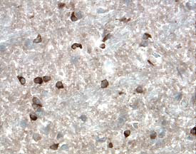 Resistin antibody in Mouse Brain by Immunohistochemistry (IHC-Fr).
