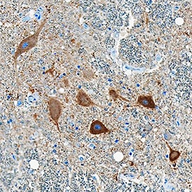 Ret antibody in Human Spinal Cord by Immunohistochemistry (IHC-P).