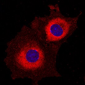 Ribosomal Protein S6/RPS6 antibody in MM55K Mouse Cell Line by Immunocytochemistry (ICC).