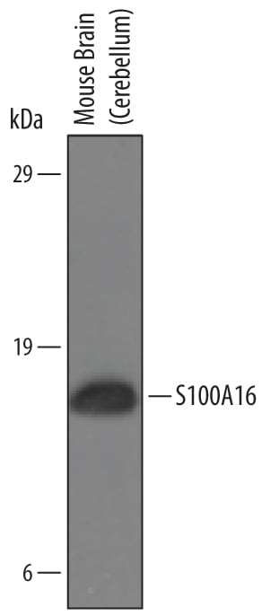 Detection of Mouse S100A16 antibody by Western Blot.