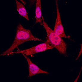 S100A2 antibody in MDA-MB-231 Human Cell Line by Immunocytochemistry (ICC).