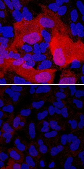 S100A4 antibody in A549 Human Cell Line by Immunocytochemistry (ICC).