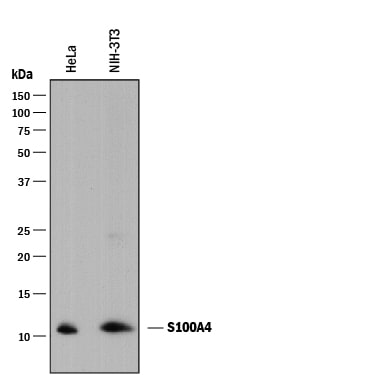 Detection of Human and Mouse S100A4 antibody by Western Blot.