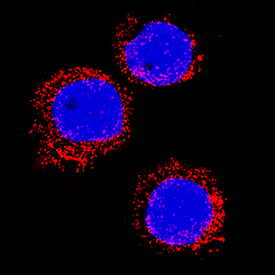 S100A8/S100A9 Heterodimer antibody in HL60 Human Cell Line by Immunocytochemistry (ICC).