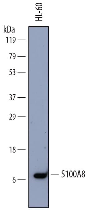 Detection of Human S100A8 antibody by Western Blot.