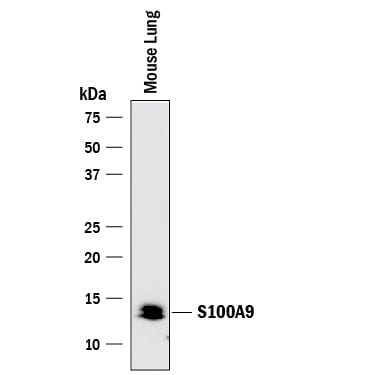 Detection of Mouse S100A9 antibody by Western Blot.