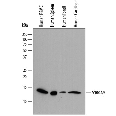 Detection of Human S100A9 antibody by Western Blot.