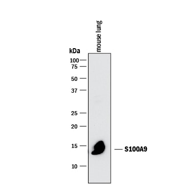 Detection of Mouse S100A9 antibody by Western Blot.