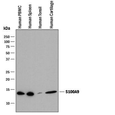 Detection of Human S100A9 antibody by Western Blot.