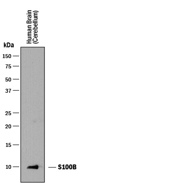 Detection of Human S100B antibody by Western Blot.
