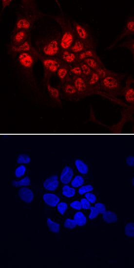 SART1 antibody in HepG2 Human Cell Line by Immunocytochemistry (ICC).