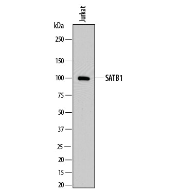 Detection of Human SATB1 antibody by Western Blot.