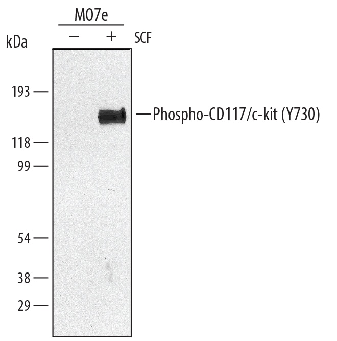 Detection of Human Phospho-CD117/ c-kit (Y730) antibody by Western Blot.