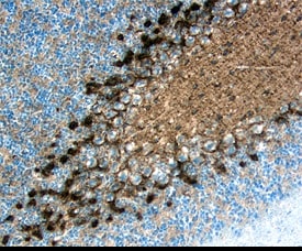 CD117/c-kit antibody in Mouse Brain by Immunohistochemistry (IHC-Fr).