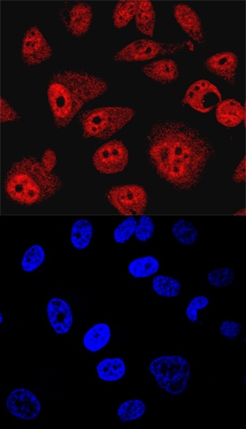 SHIP2 antibody in PC-3 Human Cell Line by Immunocytochemistry (ICC).
