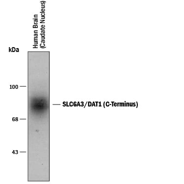 Detection of SLC6A3/DAT1 (C-Terminus) antibody by Western Blot.