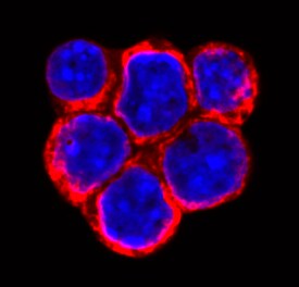 SLITRK6 antibody in Raji Human Cell Line by Immunocytochemistry (ICC).