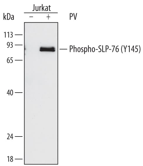 Detection of Human Phospho-SLP-76/LCP2 antibody by Western Blot.