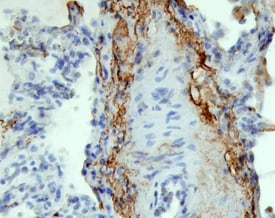 SLPI antibody in Human Lung by Immunohistochemistry (IHC-P).