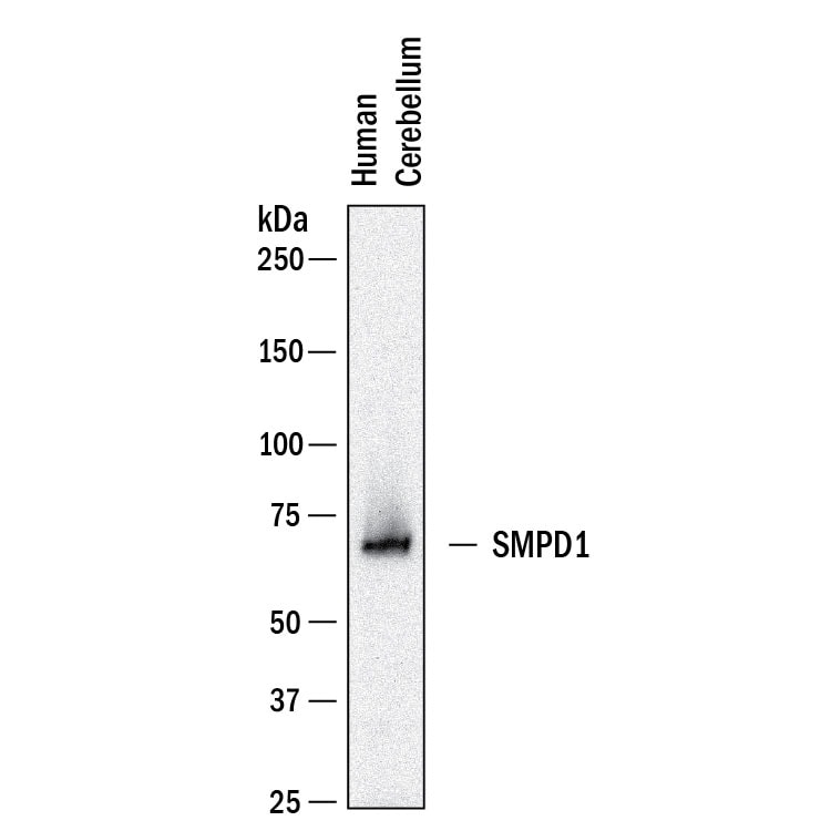 Detection of Human SMPD1 antibody by Western Blot.