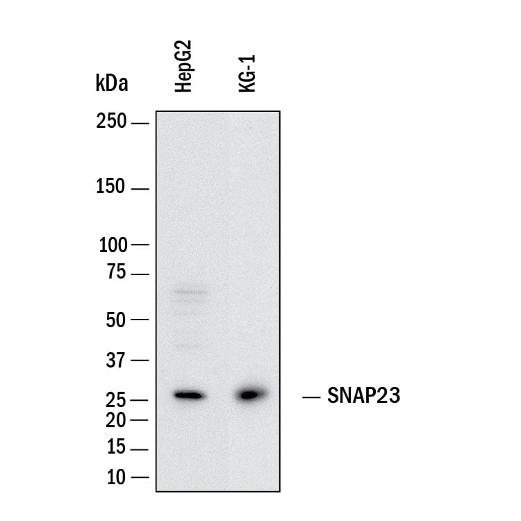 Detection of Human SNAP23 antibody by Western Blot.
