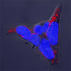 SNAP25 antibody in PC-12 Rat Adrenal Pheochromocytoma Cells by Immunocytochemistry (ICC).