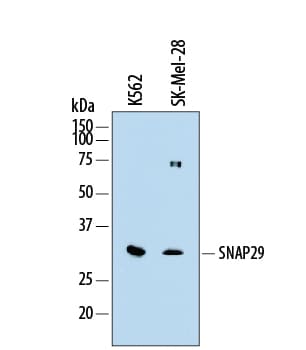 Detection of Human SNAP29 antibody by Western Blot.