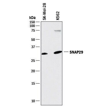 Detection of Human SNAP29 antibody by Western Blot.