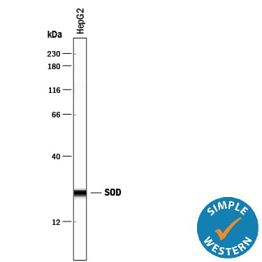 Detection of Human SOD1/Cu‑Zn SOD antibody by Simple WesternTM.