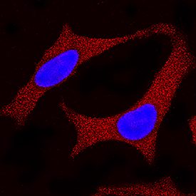 SOD1/Cu-Zn SOD antibody in HeLa Human Cell Line by Immunocytochemistry (ICC).