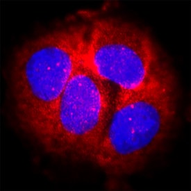 SOD2/Mn-SOD antibody in MCF-7 Human Cell Line by Immunocytochemistry (ICC).
