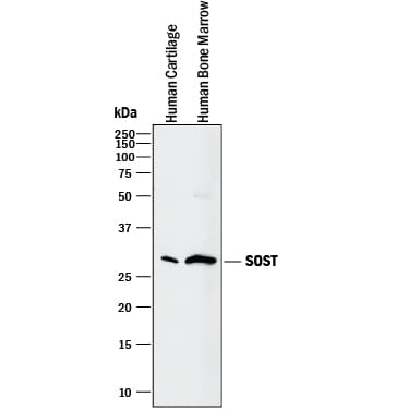 Detection of Human SOST/Sclerostin antibody by Western Blot.