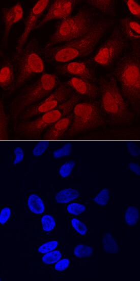 SOX11 antibody in HeLa Human Cell Line by Immunocytochemistry (ICC).