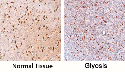 SOX11 antibody in Human Brain by Immunohistochemistry (IHC-P).