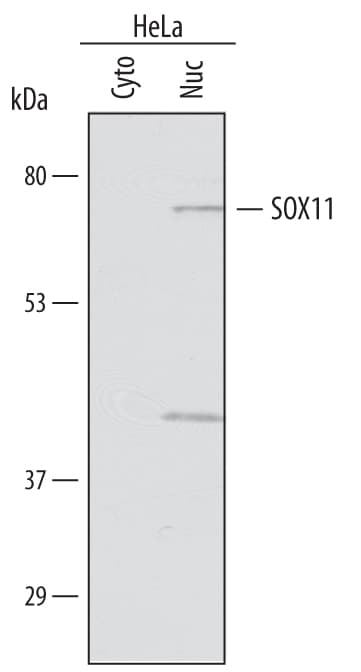 Detection of Human SOX11 antibody by Western Blot.