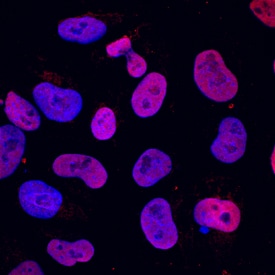 SOX15 antibody in Human iPSK3 cells by Immunocytochemistry (ICC).