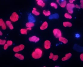 SOX17 antibody in B16 Mouse Cell Line by Immunocytochemistry (ICC).
