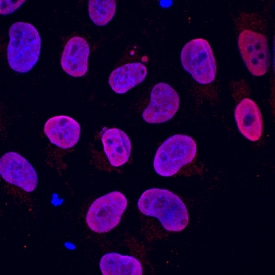SOX2 antibody in Human iPSK3 cells by Immunocytochemistry (ICC).
