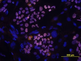 SOX2 antibody in BG01V Human Embryonic Stem Cells by Immunocytochemistry (ICC).