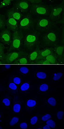 SOX3 antibody in NTera-2 Human Cell Line by Immunocytochemistry (ICC).