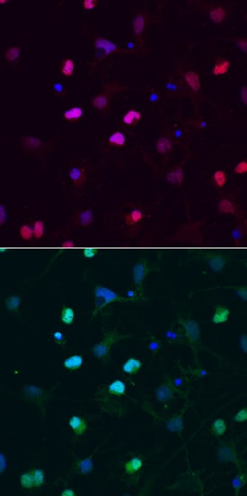 SOX6 antibody in Rat Cortical Stem Cells by Immunocytochemistry (ICC).