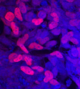 SOX9 antibody in BG01V Human Embryonic Stem Cells by Immunocytochemistry (ICC).