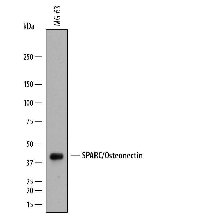 Detection of Human SPARC antibody by Western Blot.