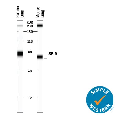 Detection of Human and Mouse SP-D antibody by Simple WesternTM.